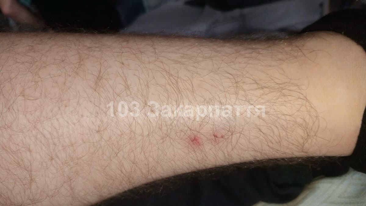Fiatal férfit mart meg kígyó Perecsenyi térségében