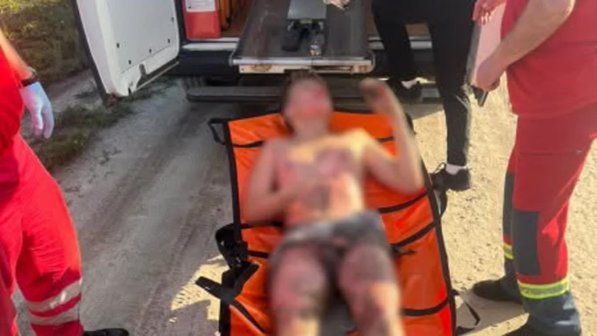 Súlyos áramütés érte a 13 éves fiút Lembergben egy vonatkocsi tetején