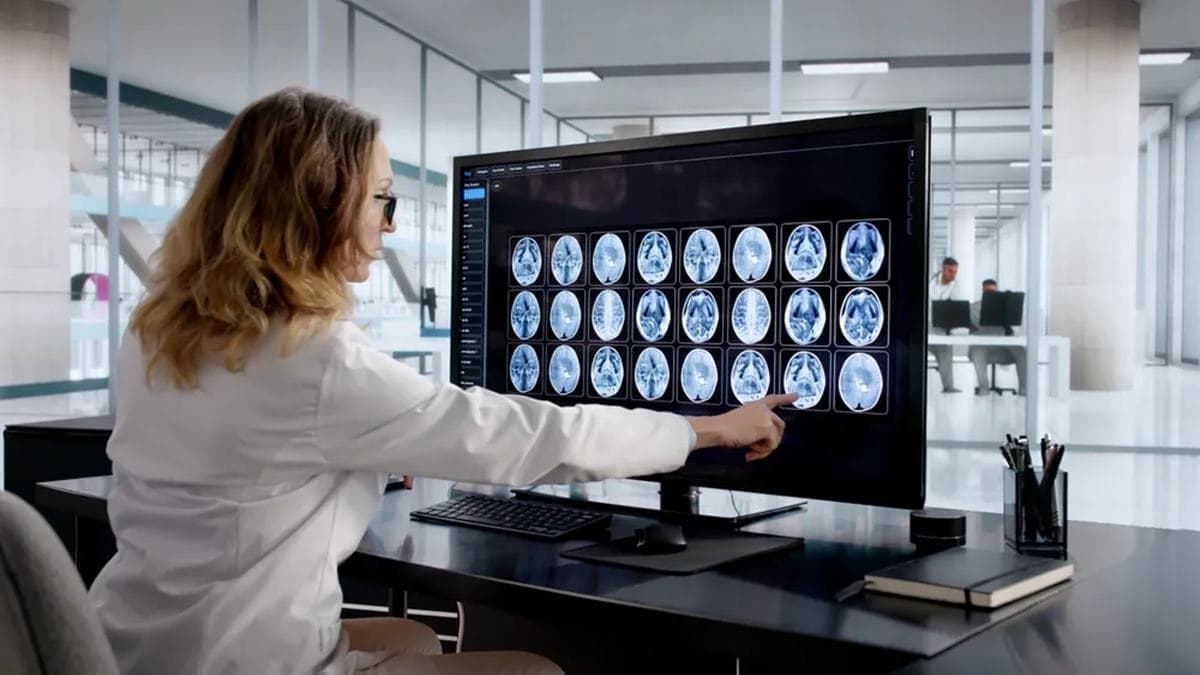 Új fényben a női agy a menopauza idején: alkalmazkodás és stabilizálódás MRI-felvételeken