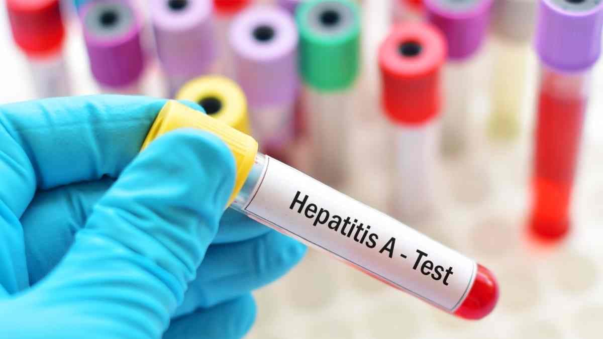 Hepatitis A járvány a Beregszászi kistérségben: már 28 megbetegedés