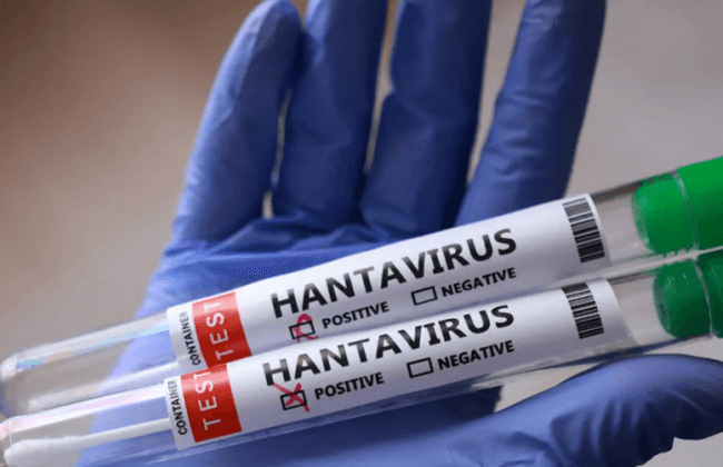 Mit kell tenni hantavírusfertőzés gyanúja esetén – mik az első tünetek és mikor kell sürgősen mentőt hívni?