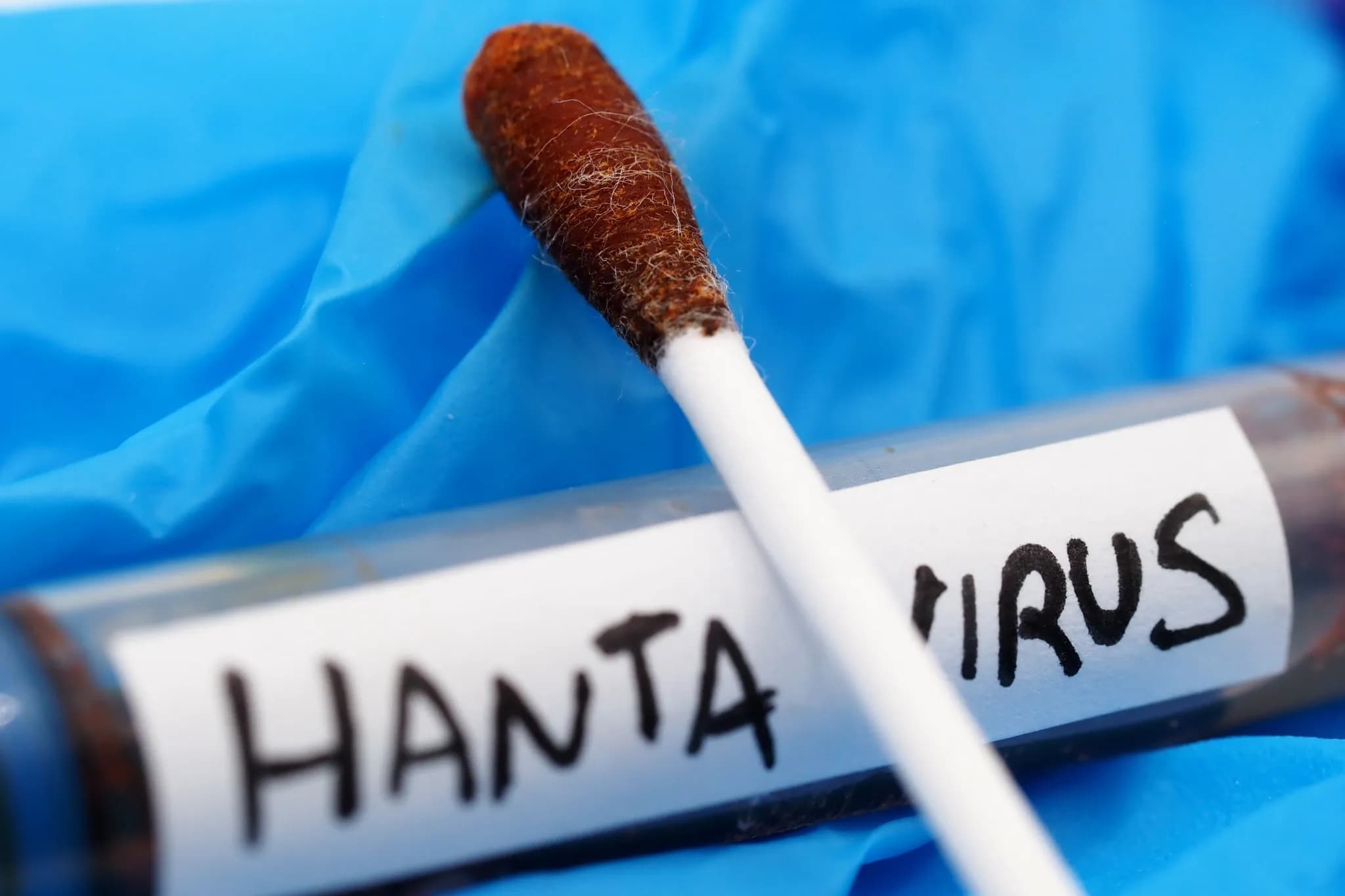 A WHO nem talált mutációt a hantavírusban a hajón történt kitörés után