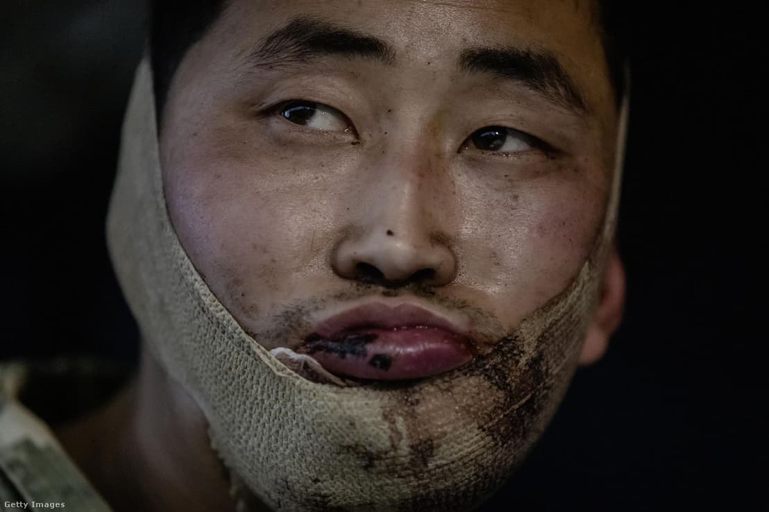 Dél-Korea befogadná az ukrán hadifogságba esett észak-koreai katonákat
