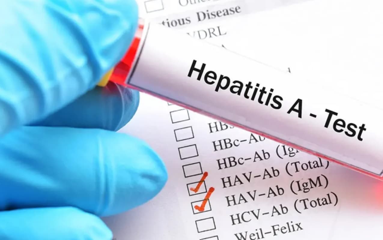 Fertőzésveszély a Perecsenyi kistérségben: Hepatitis A-járvány ütötte fel a fejét Drugetházán