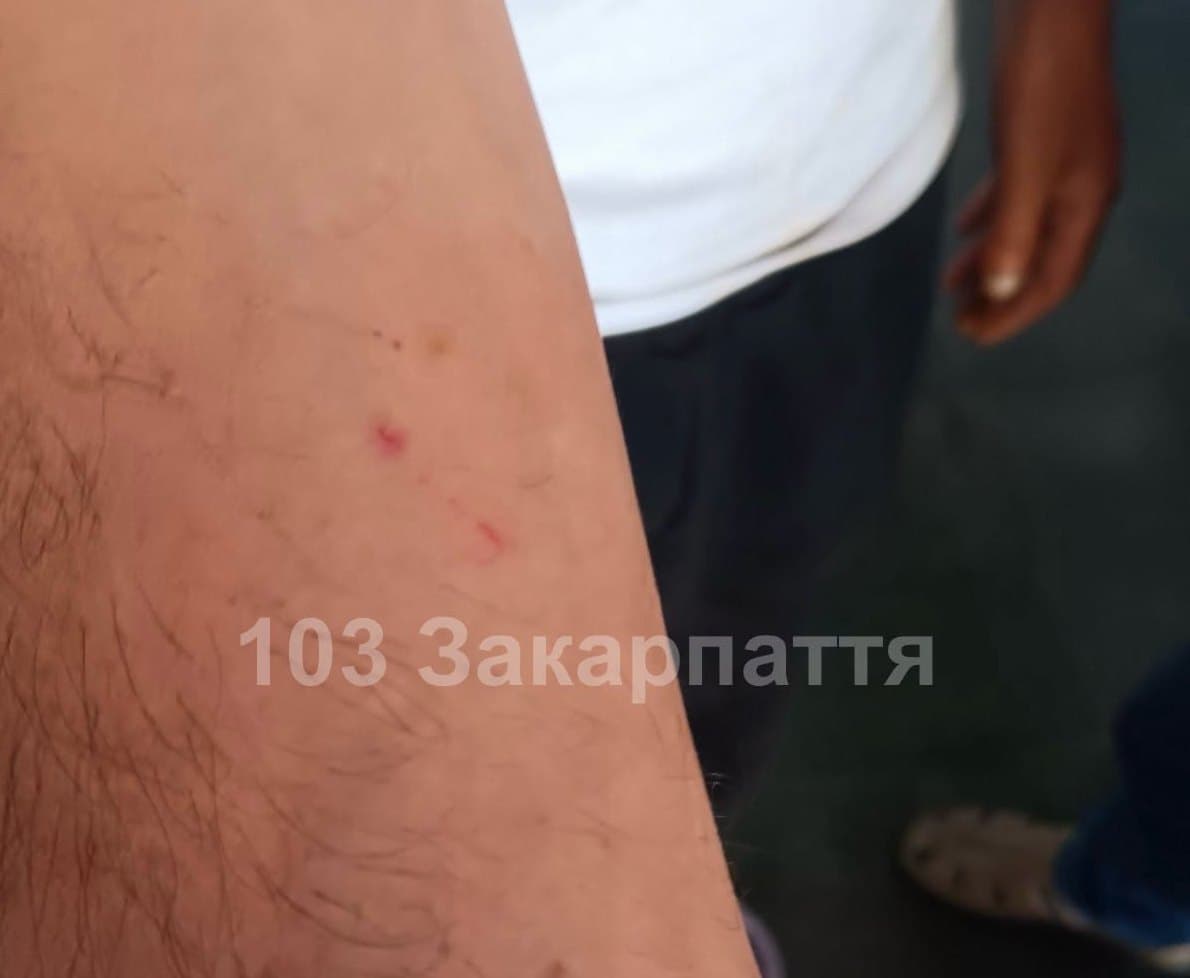 Kígyómarás miatt kórházba szállítottak egy férfit Kárpátalján