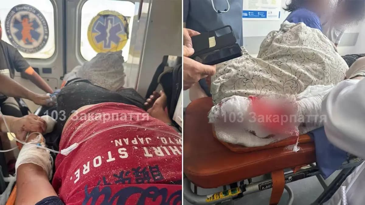 Tragikus baleset Dubovén: 17 éves fiú súlyos sérüléseket szenvedett körfűrész használata közben
