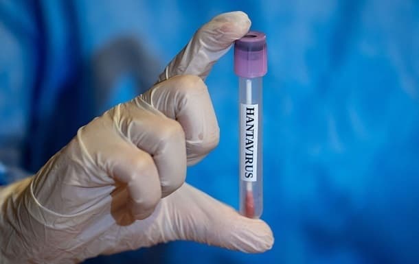 Lemberg megyében hantavírusfertőzést diagnosztizáltak egy férfinál
