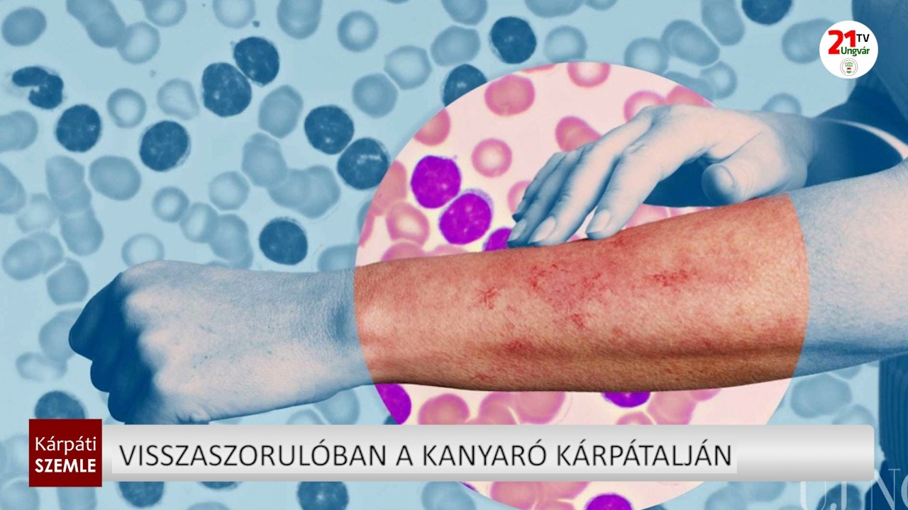 Csökken a kanyarós esetek száma Kárpátalján