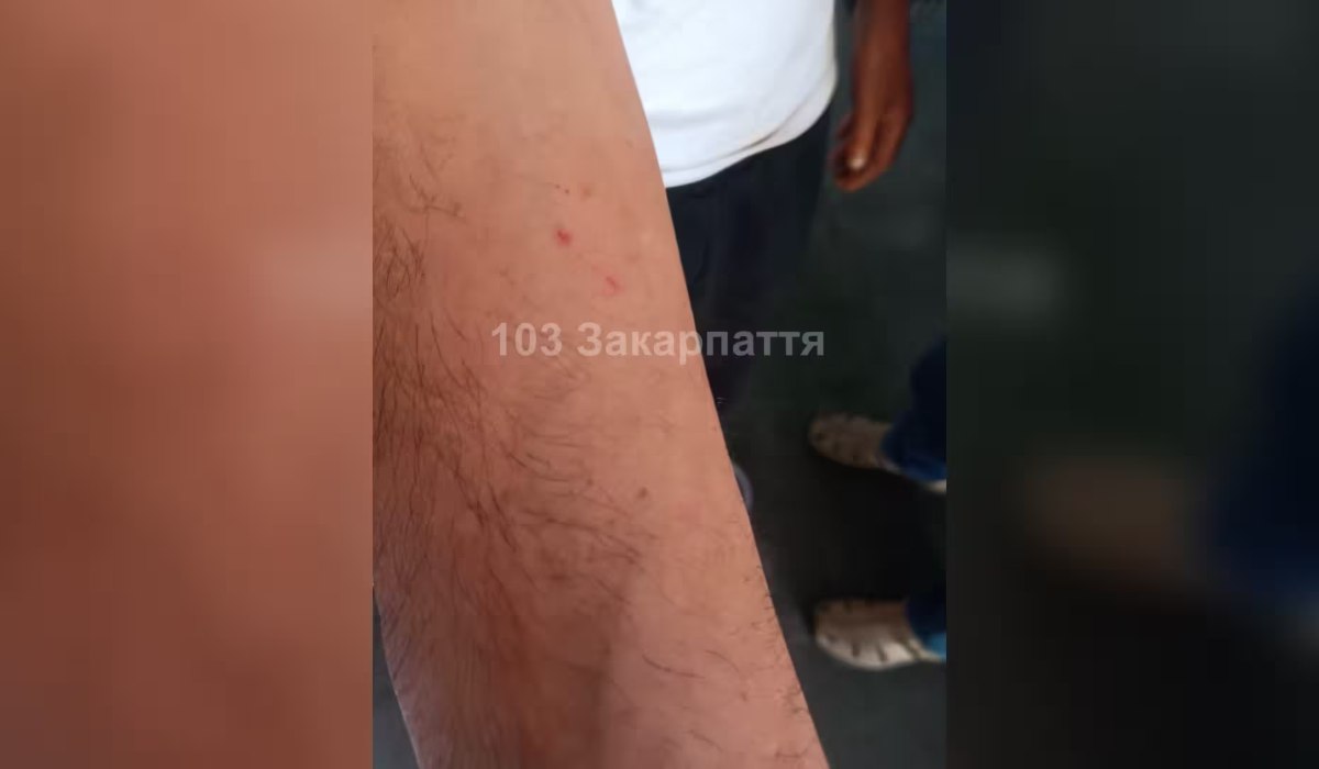 Kígyómarás gyanújával kórházba szállítottak egy férfit a Técsői járásban
